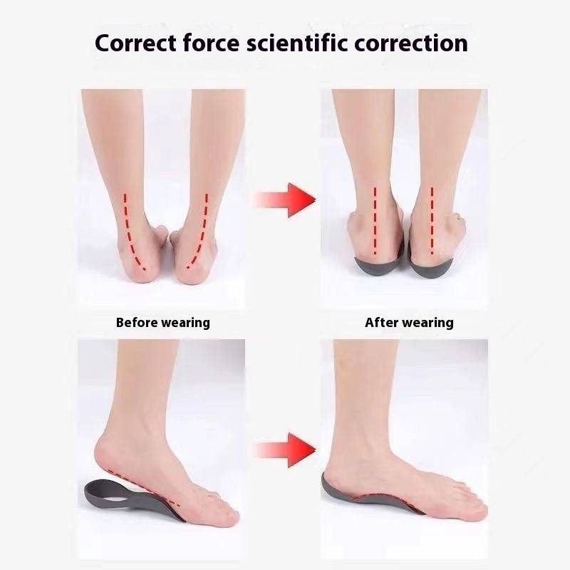 Flat Foot Correction Heel Insole - NashPull